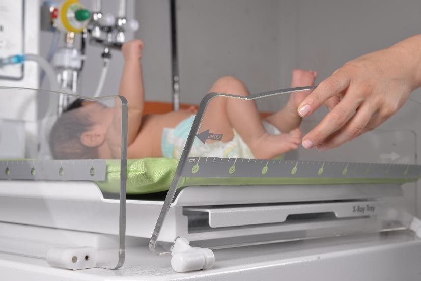 Echipamente Moderne la Spitalul de Urgență Galați pentru Îngrijirea Neonatală